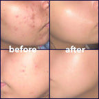 Aevinta serum results - skin brightening and dark spot reduction Pakistan