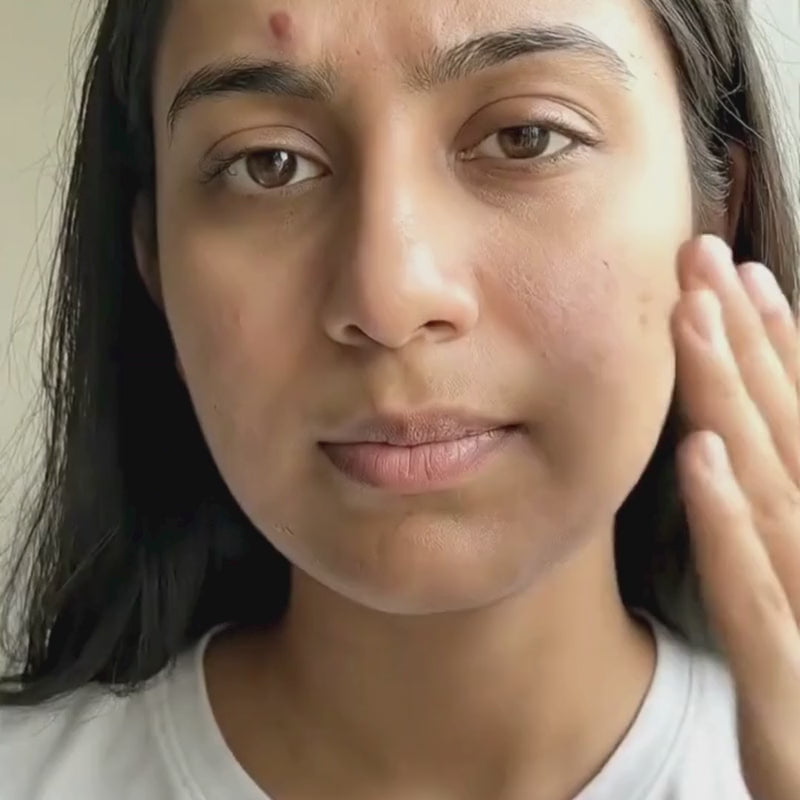 Woman applying Aevinta glutathione serum for glowing skin